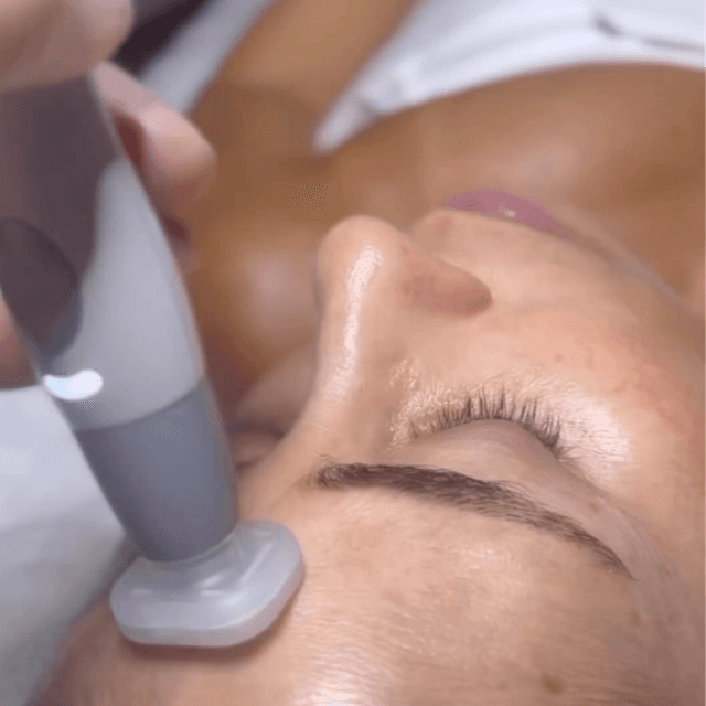 Jet Plasma - Cellular Rejuvenation