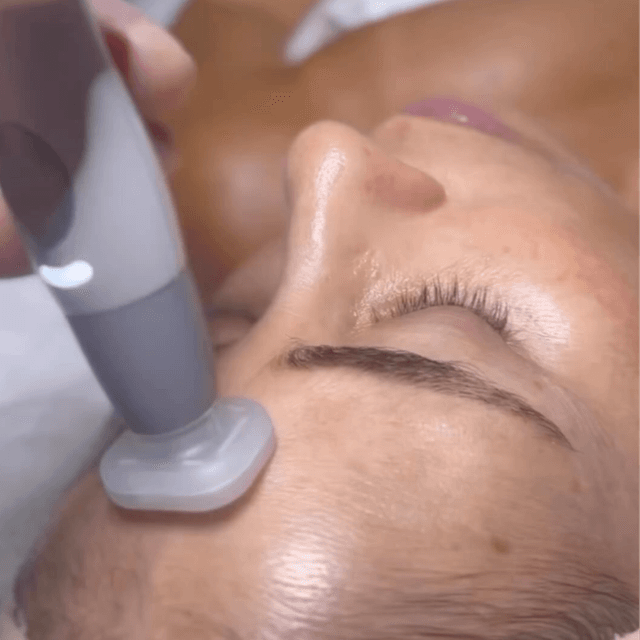 Jet Plasma - Complete Renewal