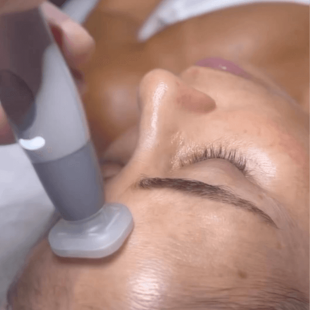 Jet Plasma - Radiant Series